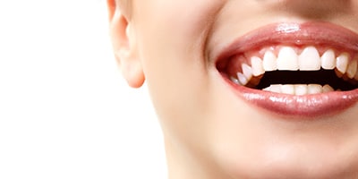 Tooth whitening Bristol